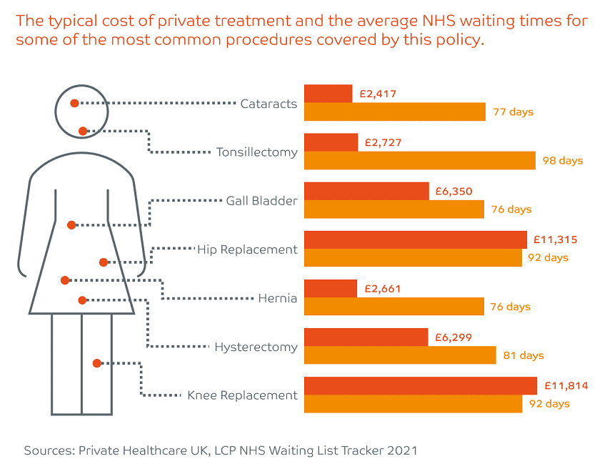 Cost of private treatment and nhs waiting times