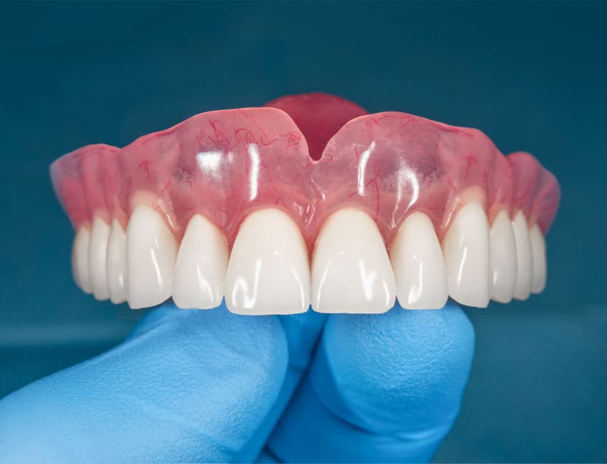 partial dentures